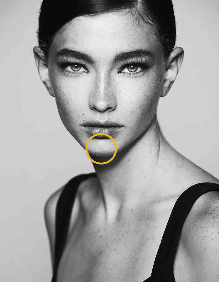 Brunette mit Sommersprossen Frau mit Kreismarkierung im Bereich Erdbeerkinn / Pflastersteinkinn